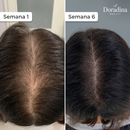 Doradina Ritual Capilar